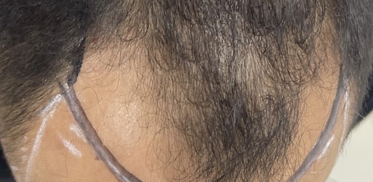 قبل: منطقة التاج معلّمة قبل الجلسة
