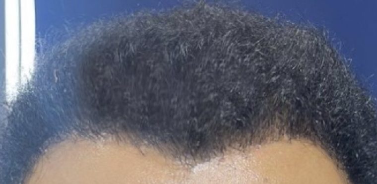 بعد: خط الشعر نفذ زي ما اترسم بالظبط