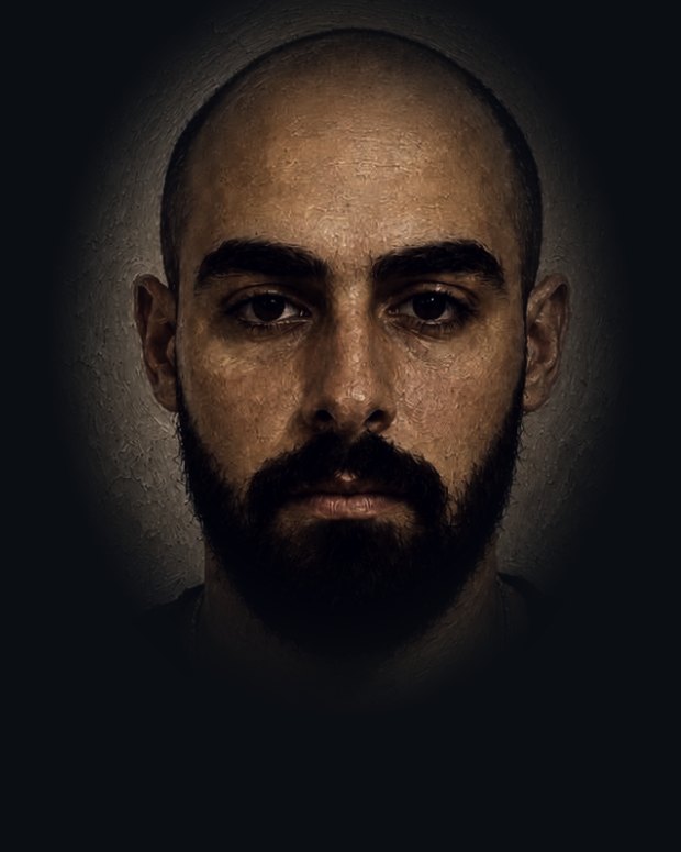 قبل: انحسار كامل لخط الشعر